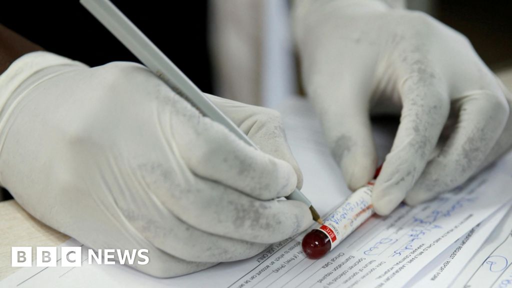 Zimbabwe rejects US health deal over sensitive data concerns